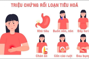  NHỮNG BIỂU HIỆN CỦA RỐI LOẠN TIÊU HÓA 