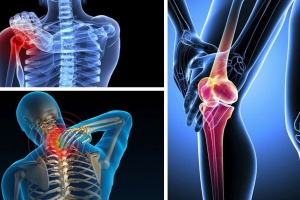 SỰ KẾT HỢP CỦA GLUCOSAMINE VÀ CHONDROITIN ???