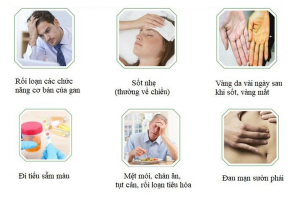 4 DẤU HIỆU SAU BỮA ĂN CẢNH BÁO GAN NHIỄM MỠ