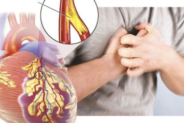  ĐAU NGỰC: TRIỆU CHỨNG – NGUYÊN NHÂN – CÁCH PHÒNG NGỪA