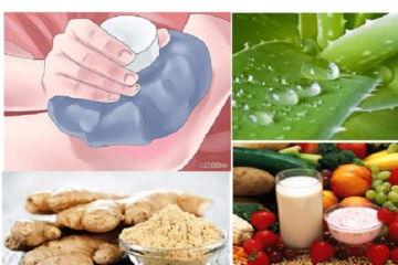  MỀ ĐAY LÀ GÌ ?