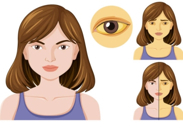 VÀNG DA LÀ GÌ? DẤU HIỆU KHÔNG NÊN BỎ QUA!