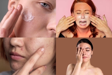 NHỮNG VẤN ĐỀ VỀ DA THƯỜNG GẶP TRONG MÙA HÈ 