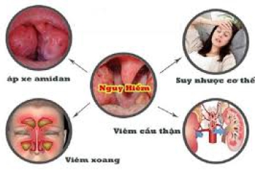VIÊM AMIDAN LÀ GÌ? TRIỆU CHỨNG VÀ CÁCH ĐIỀU TRỊ